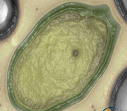 巨型阿米巴虫 法国科学家发现前所未见的巨型病毒或来自火星