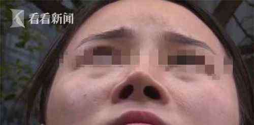 女士整容 成都艾美薇医疗美容门诊整容变毁容：美女整鼻越整越歪