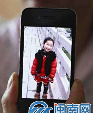狗咬的伤口图片 晋江一条大恶狗咬伤女童脸 医生：伤口愈合将留疤