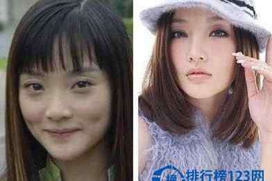 明星开眼角 明星最爱整容部位排行榜