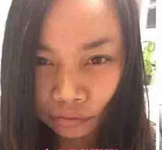 凤姐整容后的照片 凤姐整容后的照片 凤姐近况如何