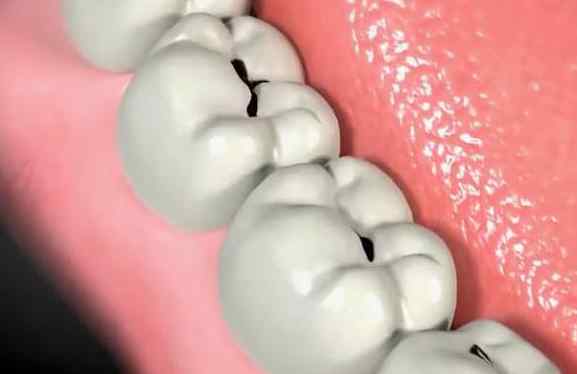 牙齿里面有黑垢图片 以下3个小妙招，帮你去除牙缝里的黑线或者牙垢