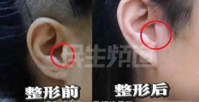 郑州女性医院接洽现代 郑州一女子做脸部提拉手术，拆完线后崩溃了，院长看了都说丢人！