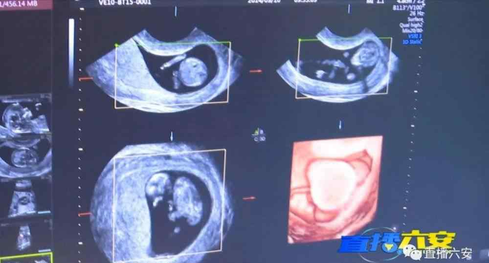 孕妇照四维 这家影楼给胎儿拍摄四维写真，真的可以吗？