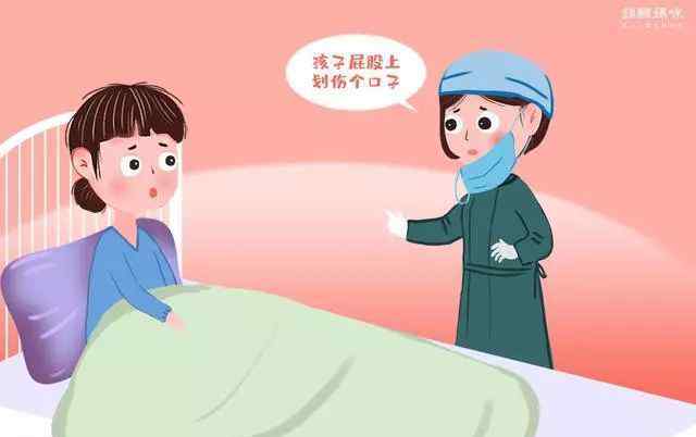 顺产安全吗 剖腹产真的比顺产安全吗？对于孩子来说安全才是第一位