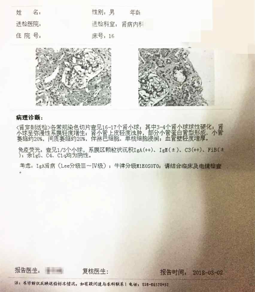 肾穿刺的利与弊 肌酐135，尿蛋白3+，复查不利一度绝望...我想对每一个挣扎中的肾友说
