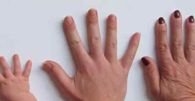 手指月牙代表什么 指甲上的月牙、竖纹、白点代表了什么？