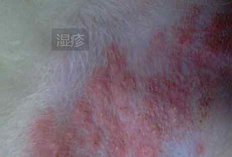 eczema 宠物常见病--湿疹
