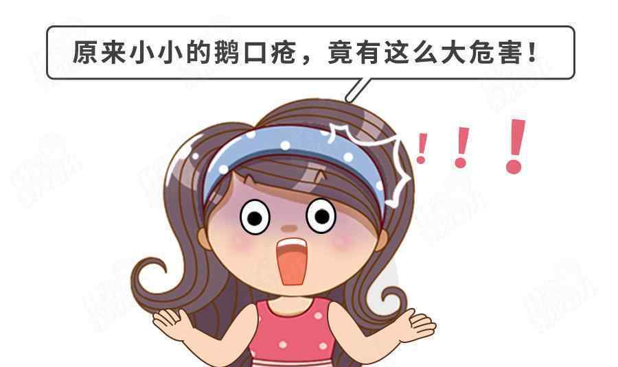 新生儿鹅口疮图片 3个习惯诱发鹅口疮，速查