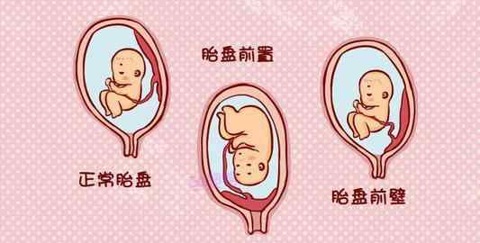 孕妇胎盘低要注意什么 胎盘低怎么办？孕妈不要害怕，想要胎盘长上去，孕期做好这4点！