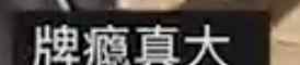 男子右手受伤自制神器单手打牌 网友看呆了：牌瘾真大！
