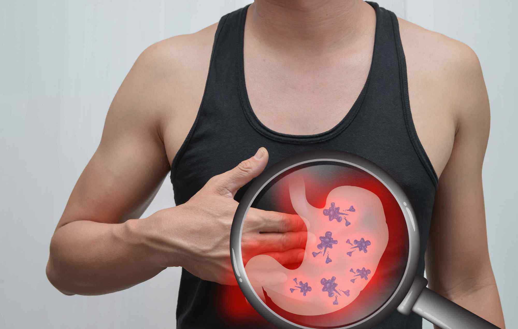 浅表性胃炎能根治吗 浅表性胃炎不简单，这些症状可以初步判断，两个方法可治疗