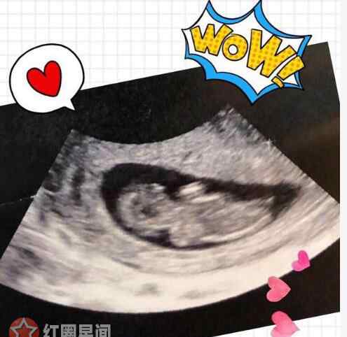 王祖蓝的爸爸 李亚男怀孕大肚照来了 2018年李亚男怀孕王祖蓝当爸爸了