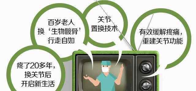 股骨头能换 股骨头“换新”能用一辈子吗？需要翻修吗？