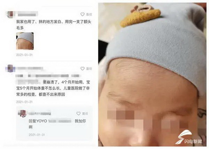 青岛三个月大婴儿使用抑菌霜变“大头娃娃”！监管已介入调查