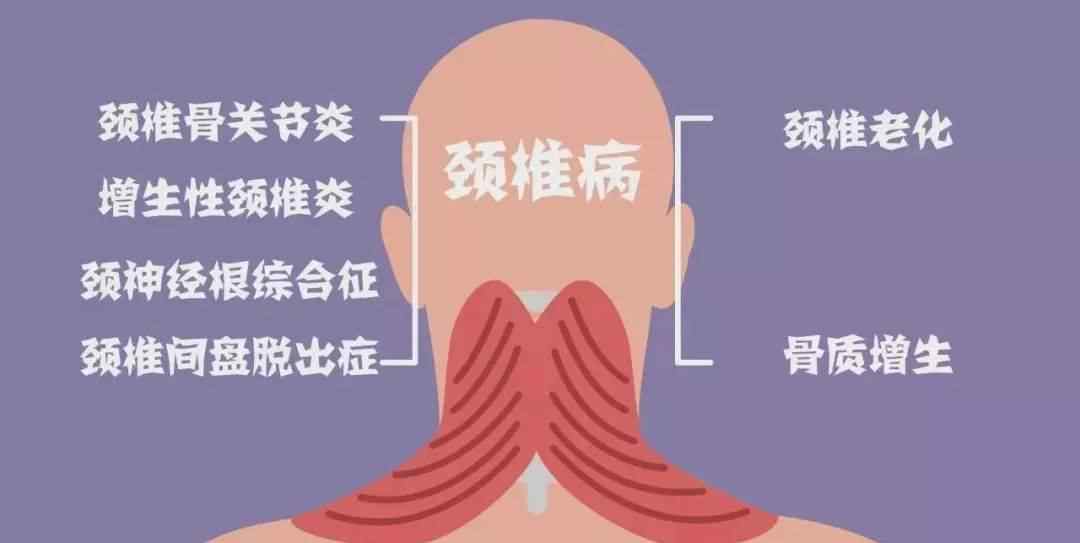 抬腿式 腰酸背痛？脖子僵硬？13个动作轻松助你缓解