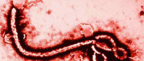 人类历史上最可怕的十大病毒：天花病毒、埃博拉病毒、狂犬病病毒