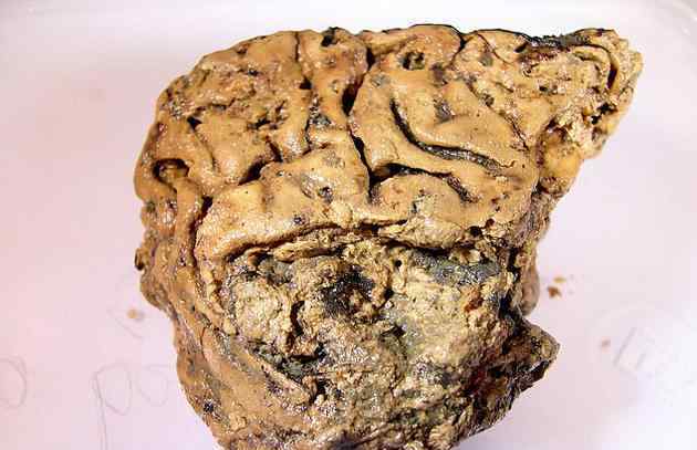 考古发现：赫斯灵顿大脑是世界上保存最完好的古人类大脑