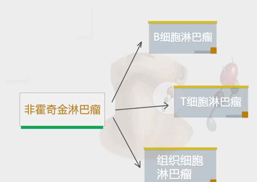 淋巴癌最后是怎么死亡 30岁的熊顿因淋巴瘤不幸去世！淋巴瘤究竟是怎么回事？能被治愈吗？