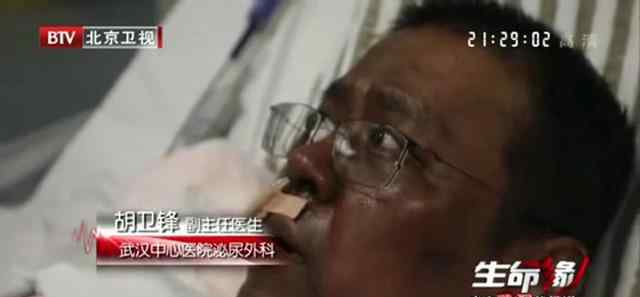 武汉中心医院易凡医生出院 什么原因导致皮肤变黑?