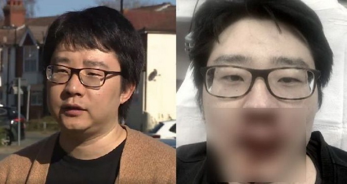 中国教师在英国遭4人围殴 接受采访时说了一句话令人深思