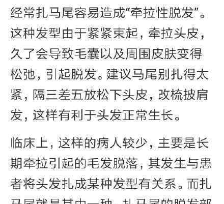 扎马尾容易脱发是真的吗如何才能减少脱发