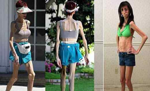世界上最瘦的女孩 世界上最瘦的女人，像纸人一样