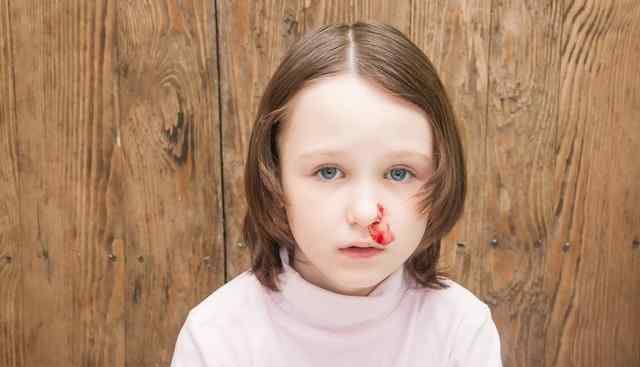 小孩子经常流鼻血是怎么回事 小孩经常流鼻血是怎么回事？4个原因可以解释清楚
