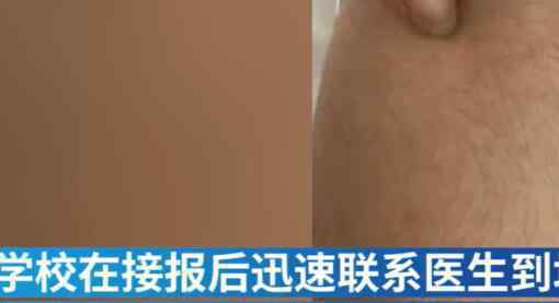 老师用圆规扎未完成作业学生 到底是什么状况？