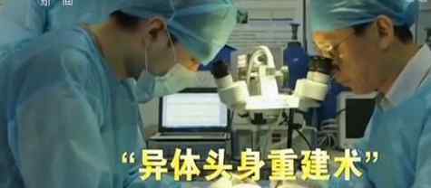 中国教授完成世界首例换头术 在遗体上进行