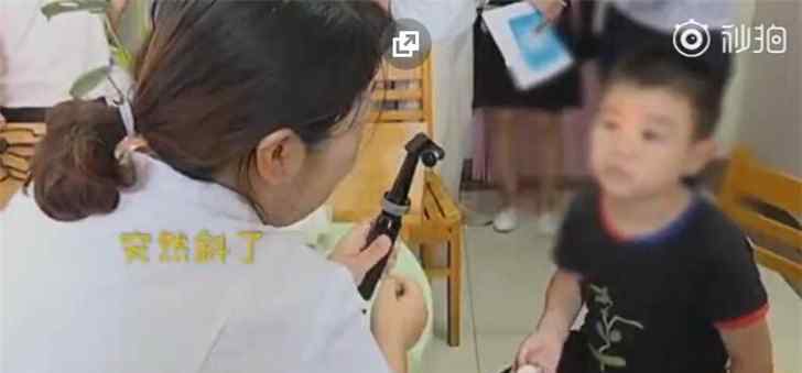 玩手机变斗鸡眼 具体是啥情况?