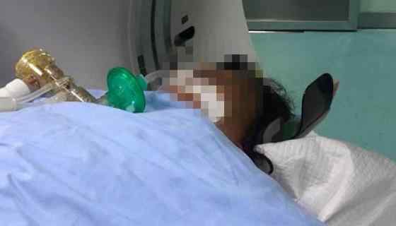 鸡西酸汤子中毒唯一幸存者去世 具体死亡几人