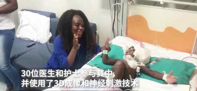 2岁连体双胞胎在意大利成功分离 还原事发经过及背后真相！