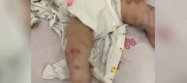 警方通报男婴被母亲殴打进ICU：其母被立案侦查