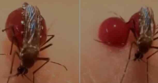 罕见蚊子趴在人体上吸血胀死 数百万人目睹全程看傻眼