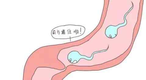 解扎手术费用大概多少 北京不孕不育医院：输卵管结扎复通手术需要多少钱 ？