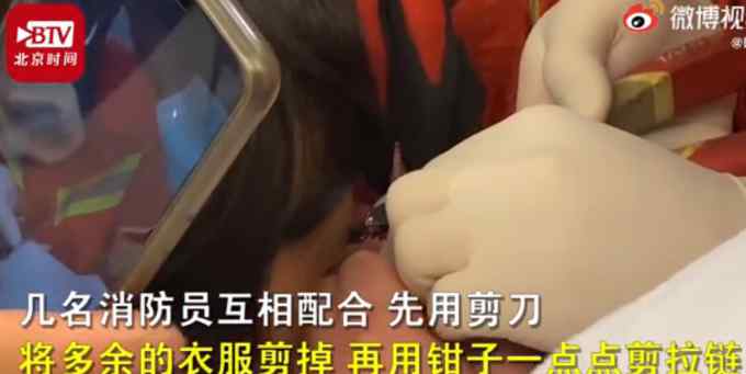 女子眼皮被拉链夹住求助消防 画面吓人！网友：鸡皮疙瘩起来了