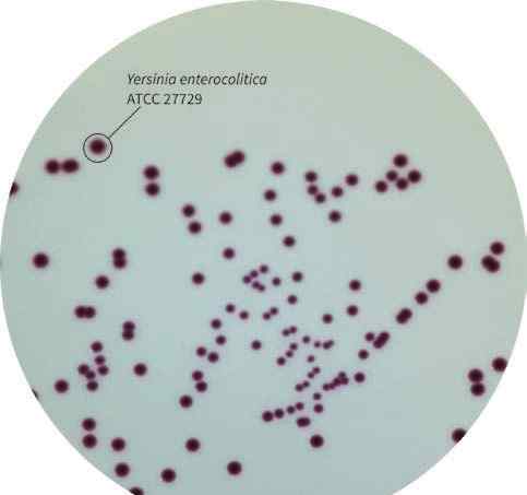 耶尔森菌 小肠结肠炎耶尔森菌的流行状况和增菌分离