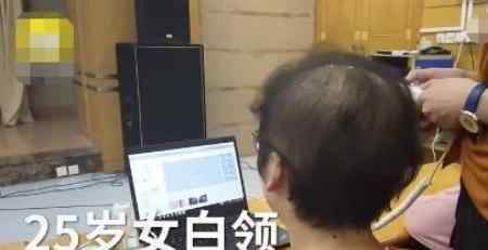 女白领发量剩3成是怎么回事脱发原因是什么