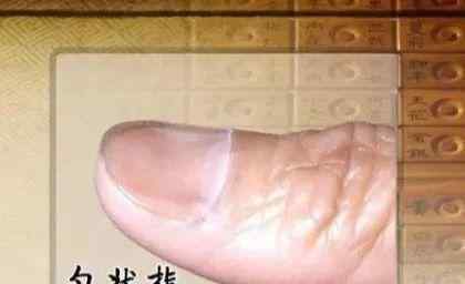 怎样判断指甲黑色素瘤 手指甲长这样，多半是身体在“求救”！6种变化一个比一个危险，赶紧自查~