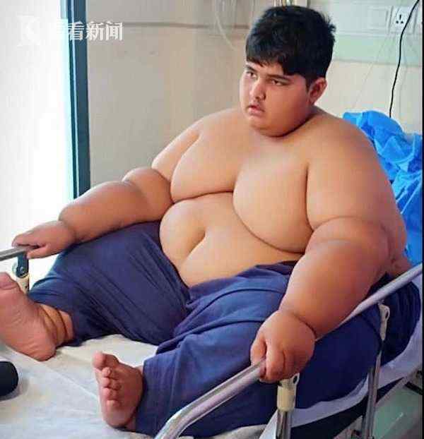 全球最胖男孩：穆罕默德·阿布拉尔