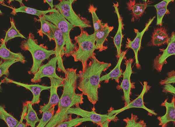 人体实验黑历史：海拉细胞污染事件 注射癌细胞人体实验
