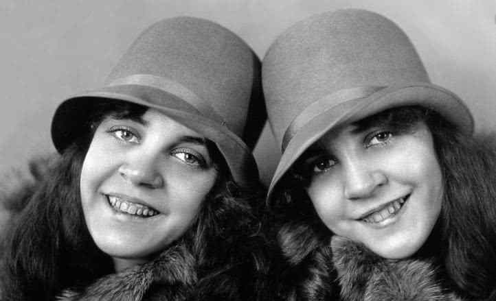 最美连体双胞胎：世界上最著名的连体双胞胎图片