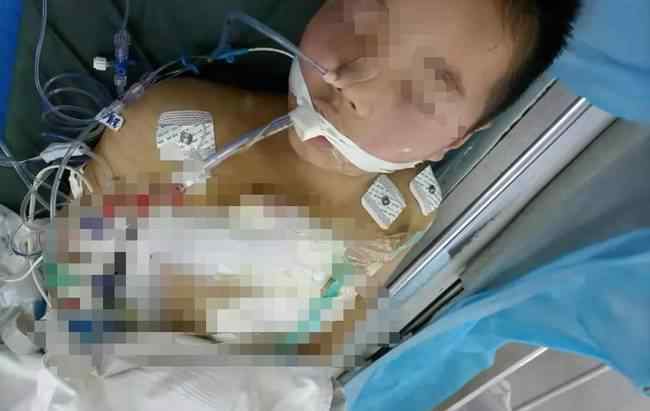 村医9岁儿子被患者刺伤