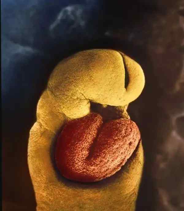 胚胎放入子宫游走图片 超震撼！摄影师记录胎儿在子宫内诞生全过程