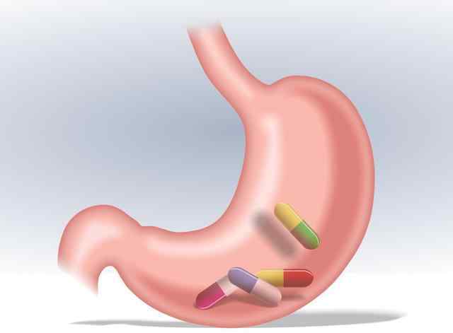 胃溃疡食物禁忌 为什么胃溃疡患者不能吃小苏打？应该怎么吃？这2类是绝对禁忌