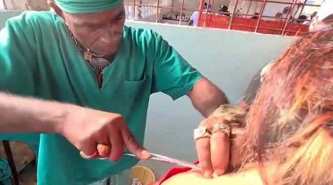 古巴一治疗师用砍刀为患者进行手术 到底什么情况呢？