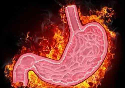 清胃火的十种中药 胃火旺让你口臭经常上火，重用1味中药，扑灭胃火，调理胃炎