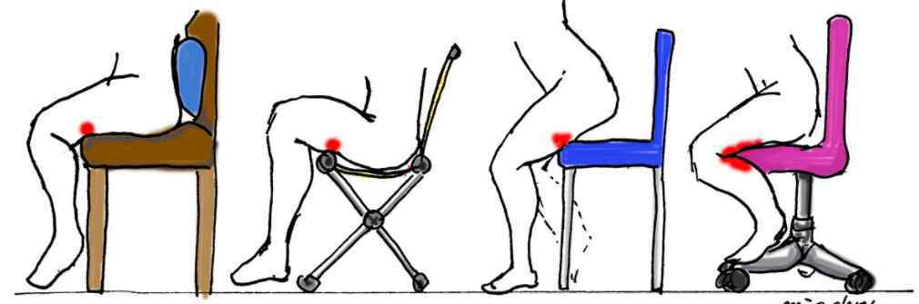 屁股连着大腿后侧筋痛 久坐后出现屁股酸痛，可能是大腿后侧“腘绳肌”惹祸