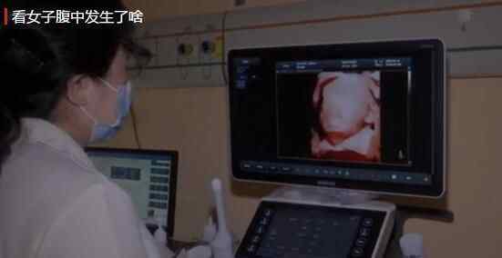 湖南长沙女子怀孕8个月腹中突然没动静 医生剖腹手术后看到可怕一幕